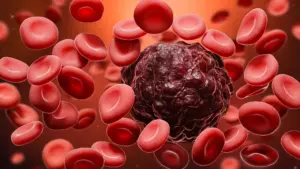 Genetically Engineered Stem Cell Transplants Offer New Shield Against Relapse in Aggressive Blood Cancers